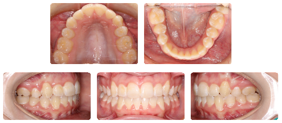 Smile 01: after treatment dental views