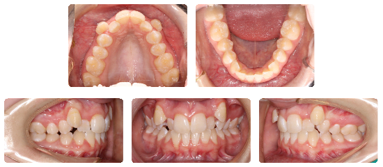 Smile 01: before treatment dental views