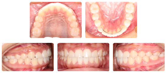 Smile 02: after treatment dental views