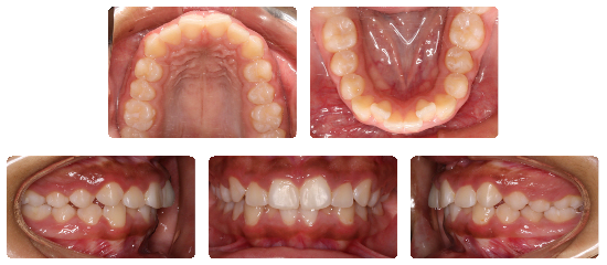 Smile 02: before treatment dental views