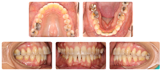 Smile 03: after treatment dental views