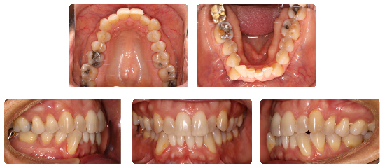 Smile 03: before treatment dental views
