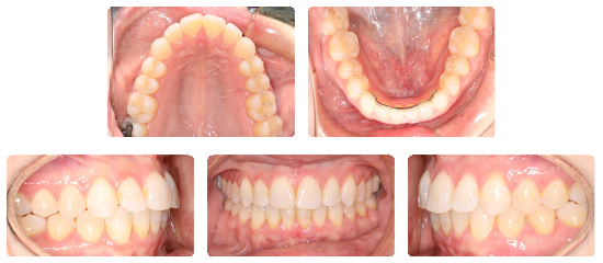 Smile 04: after treatment dental views