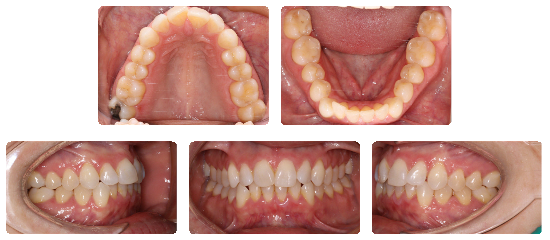 Smile 04: before treatment dental views