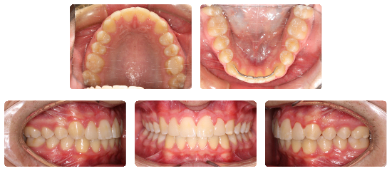 Smile 05: after treatment dental views