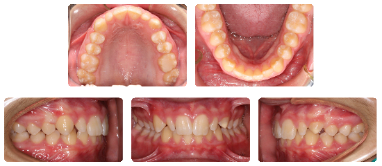 Smile 05: before treatment dental views
