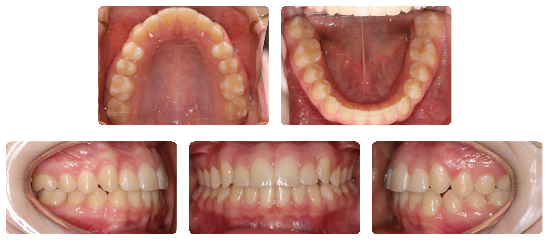 Smile 06: after treatment dental views
