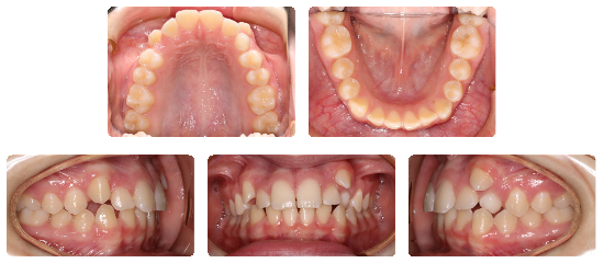 Smile 06: before treatment dental views
